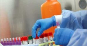 28-times-confirmed-coronavirus-infection-in-the-body-after_SECVPF-620x330