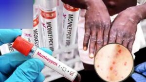 WhatsApp Image 2024-08-17 at 11.54.34 AM