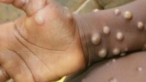 WhatsApp Image 2024-08-20 at 12.40.46 PM